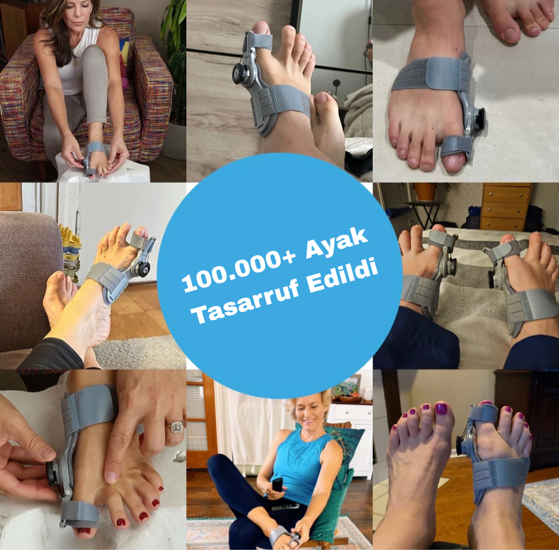 Ayak baş parmak kemiği düzeltici